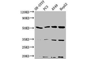 Western Blot Positive WB detected in: SH-SY5Y whole cell lysate, PC-3 whole cell lysate, A549 whole cell lysate, HepG2 whole cell lysate All lanes: NAGPA antibody at 3. (NAGPA Antikörper  (AA 327-438))