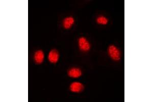 Immunofluorescent analysis of RUNX1 staining in THP1 cells. (RUNX1 Antikörper  (Center))