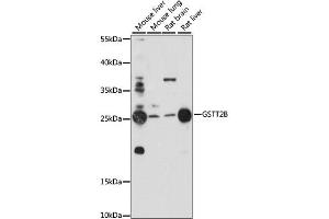 Western blot analysis of extracts of various cell lines, using GSTT2B antibody. (GSTT2B Antikörper)
