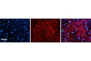 Rabbit Anti-S100A8 Antibody Catalog Number: ARP61367_P050 Formalin Fixed Paraffin Embedded Tissue: Human heart Tissue Observed Staining: Secreted Primary Antibody Concentration: 1:100 Other Working Concentrations: 1:600 Secondary Antibody: Donkey anti-Rabbit-Cy3 Secondary Antibody Concentration: 1:200 Magnification: 20X Exposure Time: 0. (S100A8 Antikörper  (Middle Region))