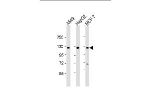 All lanes : Anti-KLB Antibody (N-Term) at 1:2000 dilution Lane 1: A549 whole cell lysate Lane 2: HepG2 whole cell lysate Lane 3: MCF-7 whole cell lysate Lysates/proteins at 20 μg per lane. (Klotho beta Antikörper  (AA 1-29))