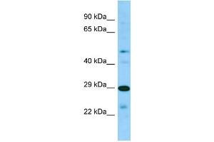 Host: Rabbit Target Name: SIRPB2 Sample Type: 721_B Whole Cell lysates Antibody Dilution: 1. (SIRPb2 Antikörper  (C-Term))