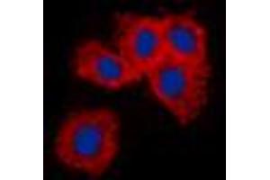 Immunofluorescent analysis of Vimentin staining in A549 cells. (Vimentin Antikörper  (N-Term))