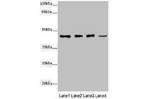 Western blot All lanes: SIRPB1 antibody at 6 μg/mL Lane 1: A549 whole cell lysate Lane 2: PC-3 whole cell lysate Lane 3: A375 whole cell lysate Lane 4: Mouse heart tissue Secondary Goat polyclonal to rabbit IgG at 1/10000 dilution Predicted band size: 44, 20 kDa Observed band size: 44 kDa (SIRPB1 Antikörper  (AA 30-371))