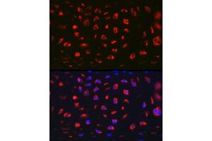 Immunofluorescence analysis of Rat cartilage using MGP Rabbit pAb (ABIN6128268, ABIN6143825, ABIN6143826 and ABIN6221090) at dilution of 1:100 (40x lens). (MGP Antikörper  (AA 20-103))