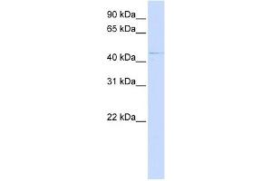 ZDHHC16 antibody used at 1 ug/ml to detect target protein. (ZDHHC16 Antikörper  (C-Term))