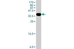 Western Blot detection against Immunogen (36. (HUWE1 Antikörper  (AA 4281-4374))