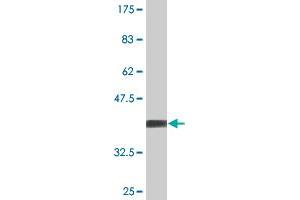 Western Blot detection against Immunogen (36. (STK16 Antikörper  (AA 1-100))