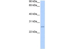 Western Blotting (WB) image for anti-Chromosome 8 Open Reading Frame 84 (C8orf84) antibody (ABIN2463542) (RPESP Antikörper)
