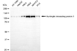 Western blotting analysis using huntingtin interacting protein 1 antibody (ABIN7799006). (Rekombinanter HIP1 Antikörper)