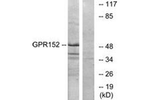 Western blot analysis of extracts from Jurkat cells, using GPR152 Antibody. (GPR152 Antikörper  (AA 10-59))