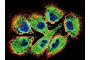 Confocal immunofluorescent analysis of EphB2 antibody with A375 cells followed by Alexa Fluor 488-conjugated goat anti-rabbit lgG (green). (EPH Receptor B2 Antikörper  (AA 1021-1050))