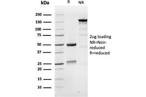 SDS-PAGE Analysis Purified MSH6 Mouse Monoclonal Antibody (MSH6/3086). (MSH6 Antikörper  (AA 374-540))