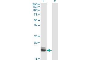 Western Blot analysis of IL15 expression in transfected 293T cell line by IL15 monoclonal antibody (M18A), clone 2F9.