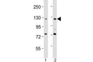Western blot testing of AATK antibody at 1:2000 dilution. (AATK Antikörper  (AA 55-90))