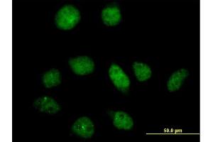 Immunofluorescence of purified MaxPab antibody to PFKFB3 on HeLa cell. (PFKFB3 Antikörper  (AA 1-520))