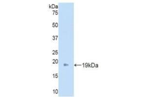 Angiopoietin 2 Antikörper  (AA 19-147)