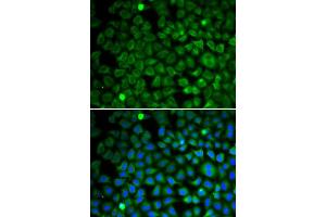 Immunofluorescence analysis of U2OS cells using NUP62 antibody (ABIN5971334). (NUP62 Antikörper)