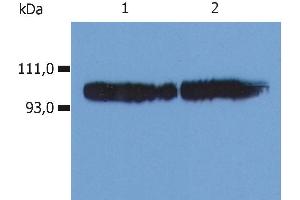 Western Blotting analysis (non-reducing conditions) of whole cell lysate using anti-human CD18 ().
