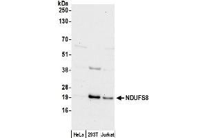 Western Blotting (WB) image for anti-NADH Dehydrogenase (Ubiquinone) Fe-S Protein 8, 23kDa (NADH-Coenzyme Q Reductase) (NDUFS8) (AA 25-75) antibody (ABIN7451009)