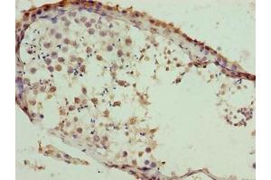 Immunohistochemistry of paraffin-embedded human testis tissue using ABIN7171798 at dilution of 1:100 (SLC26A8 Antikörper  (AA 414-595))