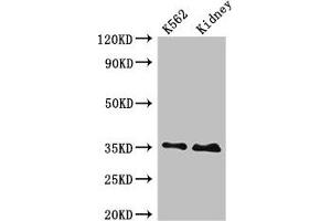 Western Blot Positive WB detected in: K562 whole cell lysate, Rat kidney tissue All lanes: TRADD antibody at 4 μg/mL Secondary Goat polyclonal to rabbit IgG at 1/50000 dilution Predicted band size: 35, 28 kDa Observed band size: 35 kDa