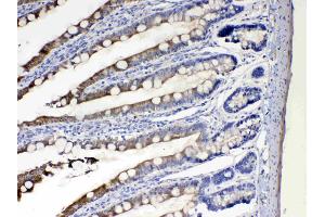 IHC analysis of Cytochrome P450 2D6 using anti- Cytochrome P450 2D6 antibody . (CYP2D6 Antikörper  (C-Term))