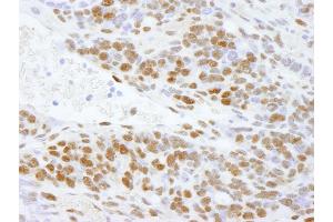 Immunohistochemistry (IHC) image for anti-DEAD (Asp-Glu-Ala-Asp) Box Polypeptide 5 (DDX5) (C-Term) antibody (ABIN7448522) (DDX5 Antikörper  (C-Term))