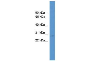 WB Suggested Anti-CLRN1 Antibody Titration: 0.