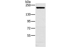 Western Blot analysis of Hela cell using NCOA3 Polyclonal Antibody at dilution of 1:200 (NCOA3 Antikörper)