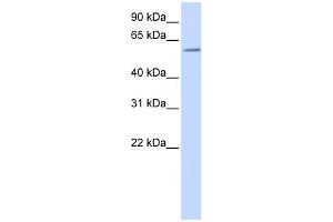 WB Suggested Anti-ZBTB7A Antibody Titration:  0.