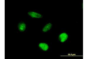 Immunofluorescence of purified MaxPab antibody to AFF4 on HeLa cell. (AFF4 Antikörper  (AA 1-365))