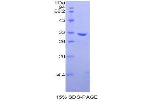 SDS-PAGE (SDS) image for Chloride Channel Accessory 1 (CLCA1) (AA 416-670) protein (His tag) (ABIN2120803)