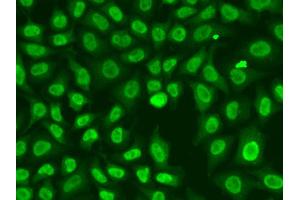 Immunofluorescence analysis of A549 cell using CHEK2 antibody. (CHEK2 Antikörper)