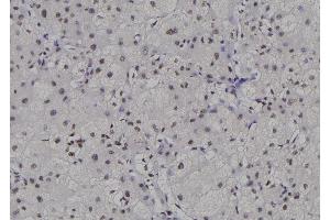 ABIN6276880 at 1/100 staining Human liver tissue by IHC-P.
