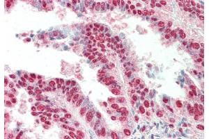Immunohistochemistry (IHC) image for anti-Iroquois Homeobox 3 (IRX3) (C-Term) antibody (ABIN2775582)