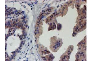 Immunohistochemical staining of paraffin-embedded Human breast tissue using anti-EIF4E2 mouse monoclonal antibody. (EIF4E2 Antikörper)