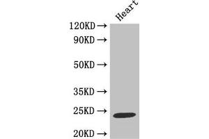 Western Blot Positive WB detected in: Mouse heart tissue All lanes: TIMP1 antibody at 2 μg/mL Secondary Goat polyclonal to rabbit IgG at 1/50000 dilution Predicted band size: 24 kDa Observed band size: 24 kDa (TIMP1 Antikörper  (AA 24-207))
