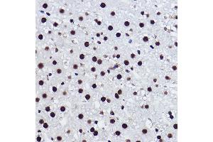 Immunohistochemistry of paraffin-embedded rat liver using BRMS1 Rabbit mAb (ABIN7265928) at dilution of 1:100 (40x lens). (BRMS1 Antikörper)