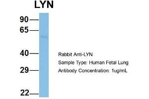 Host: Rabbit  Target Name: LYN  Sample Tissue: Human Fetal Lung  Antibody Dilution: 1. (LYN Antikörper  (N-Term))
