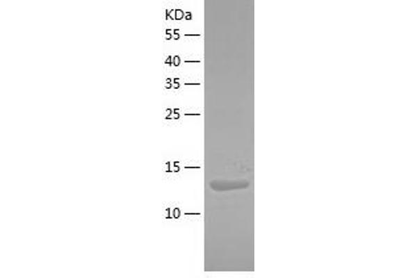 RPL31 Protein (AA 1-125) (His tag)