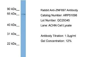 WB Suggested Anti-ZNF697  Antibody Titration: 0.