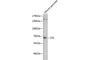 Western blot analysis of extracts of mouse pancreas, using CEL antibody (ABIN6132072, ABIN6138393, ABIN6138395 and ABIN6216837) at 1:3000 dilution. (Cholesterol Esterase Antikörper  (AA 350-550))