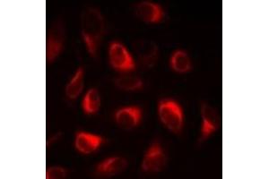Immunofluorescent analysis of FABP5 staining in A549 cells. (FABP5 Antikörper)