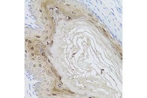 Immunohistochemistry of paraffin-embedded mouse stomach using AMBRA1 antibody (ABIN5970441) at dilution of 1/100 (40x lens). (AMBRA1 Antikörper)
