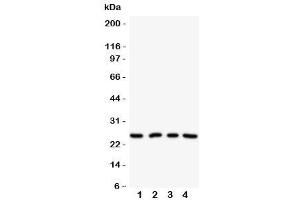 Western blot testing of NPM2 antibody on Lane 1: HeLa (NPM2 Antikörper  (N-Term))