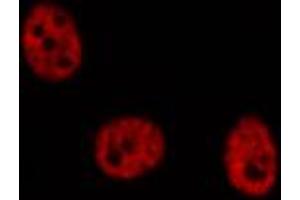 ABIN6274293 staining COLO205 cells by IF/ICC. (MLLT10 Antikörper  (Internal Region))
