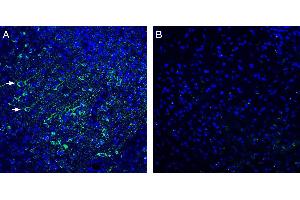 Expression of /LRRC4 in mouse cortex. (LRRC4 Antikörper  (Extracellular))