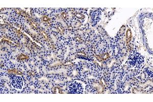 Immunohistochemistry (IHC) image for anti-Dimethylarginine Dimethylaminohydrolase 2 (DDAH2) (AA 31-265) antibody (ABIN7435682)