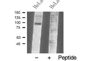 Western blot analysis of TM16J Antibody expression in Hela cells lysates. (ANO9 Antikörper  (Internal Region))